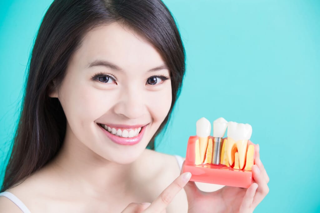 What to Expect when getting Dental Implants in St. Augustine