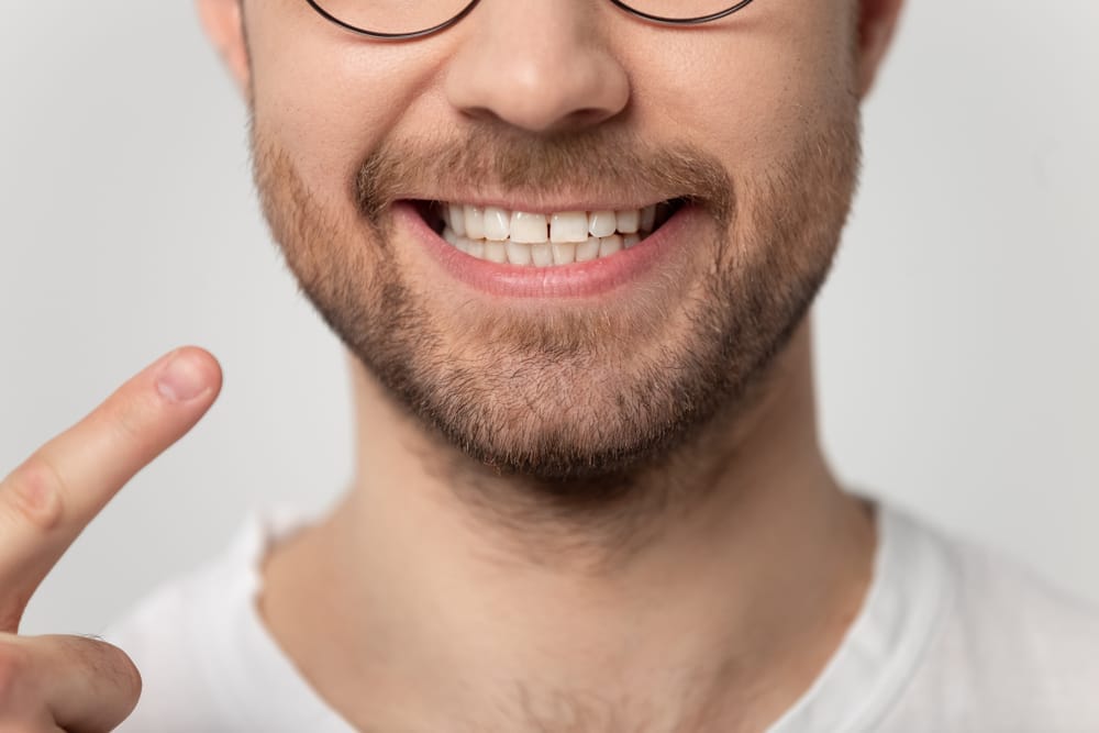 Partial view of a smiling man with a beard and glasses, pointing at his straight white teeth while wearing a casual white shirt - Dental Bridge St Augustine