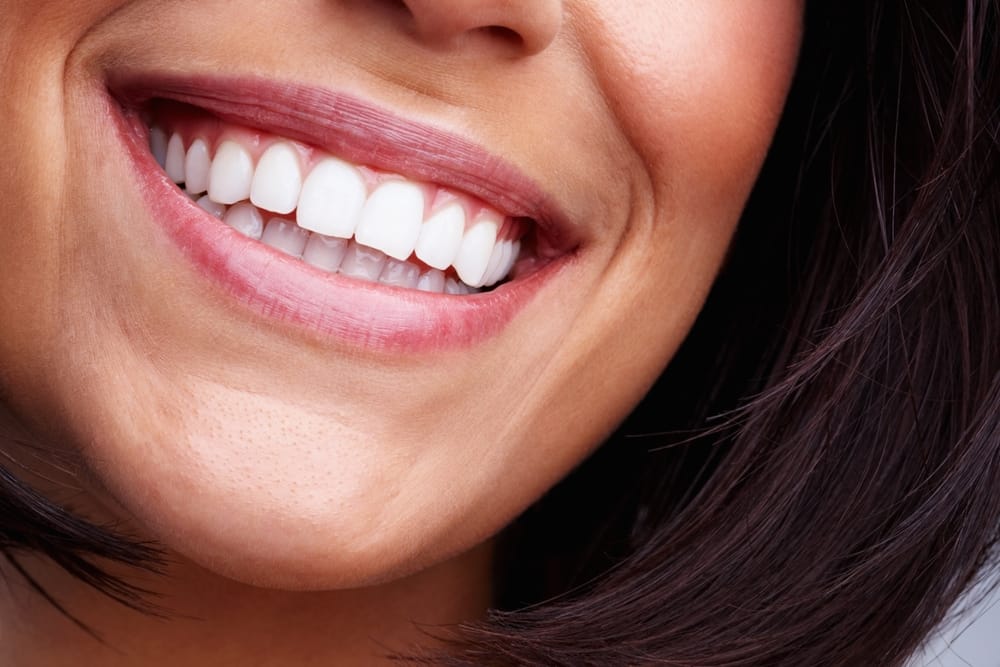 Close-Up of a Healthy, Bright Smile – Cleaning and Prevention Zoomed-in view of a smiling woman’s white, clean teeth, showing excellent oral hygiene and gum health – Cleaning and Prevention