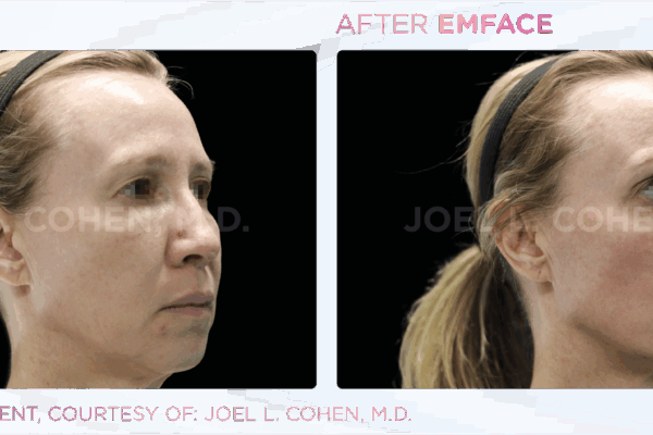 Emface_PIC_Ba-card-female-face-058_ENUS100_watermark