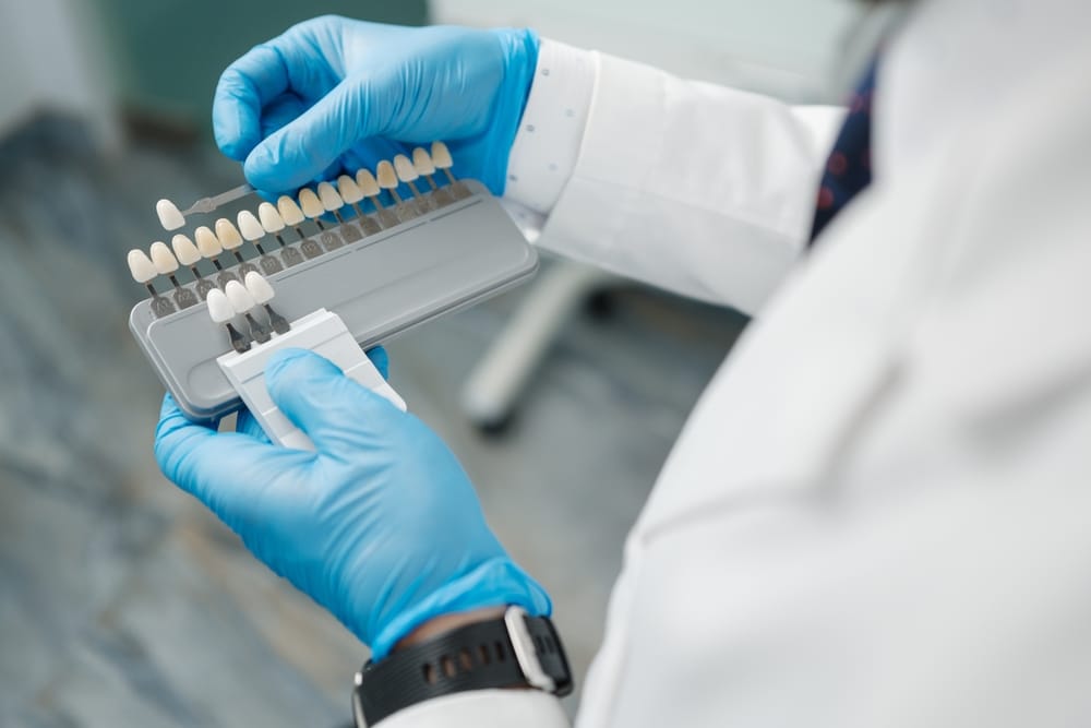 Close-up of a dentist wearing blue gloves and a white coat, holding a shade guide to match tooth color for porcelain veneers - Porcelain Veneers