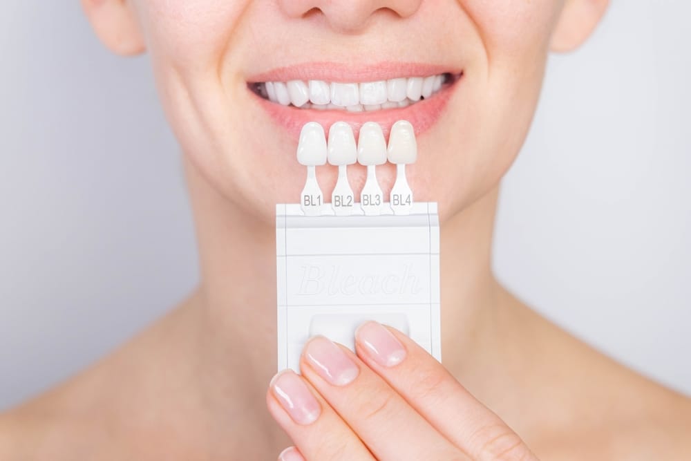 Close-up of a smiling woman holding a dental shade guide with veneer samples to match teeth color – Porcelain Veneers