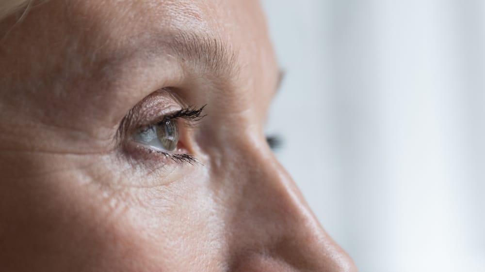 Close-Up of Mature Eye Area with Fine Lines – Fotona Laser Detailed side profile of a woman’s eye showing natural aging signs and skin texture, ideal for Fotona laser rejuvenation – Fotona Laser